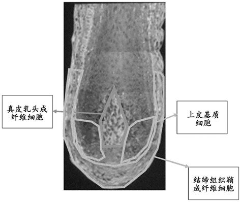 乳頭長毛|乳头毛